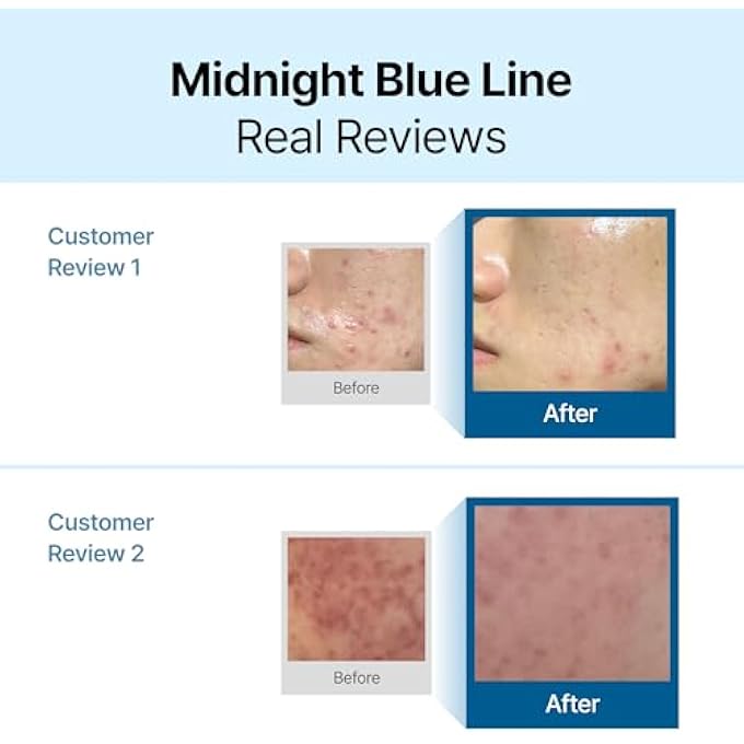 KLAIRS MIDNIGHT BLUE CALMING CREAM 60ML - Image 3